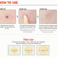 COSRX Acne Pimple Master (24 Patches) - COSRX - Korea Beauty Plaza