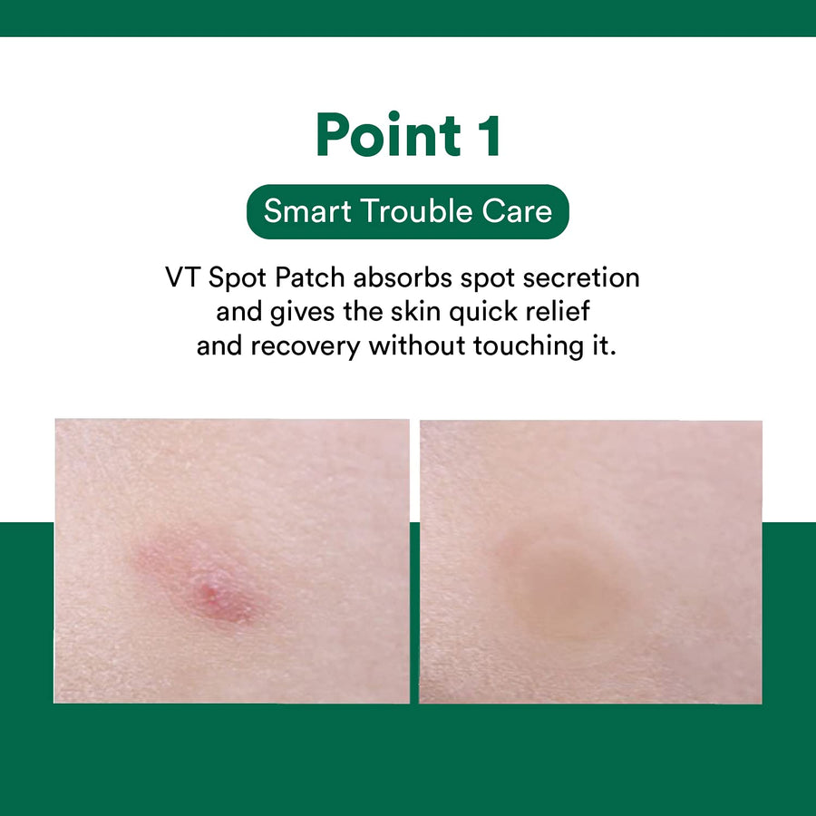 VT Cica Care Spot Patch (48pcs) - Korea Beauty Plaza